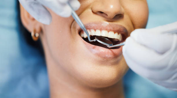 Best Emergency Treatment for Dental Infections or Abscesses in Rigby, ID